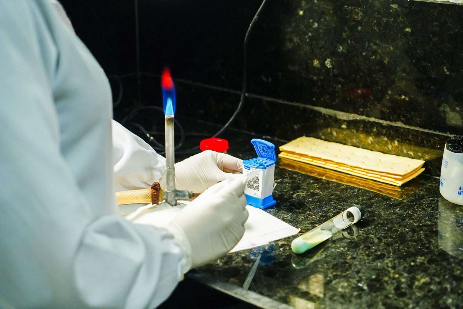 Exames de tuberculose são processados em laboratório próprio da Rede Municipal de Saúde Exames de tuberculose são processados em laboratório próprio da Rede Municipal de Saúde